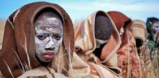 Mozambique : un projet de 1 million de dollar pour circoncire 100 000 hommes