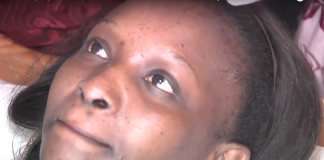 Santé : voici comment se débarasser des boutons sur le visage