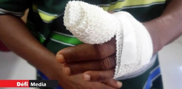 Société : Kh. Mbengue amputé du doigt après avoir été battue par sa maîtresse