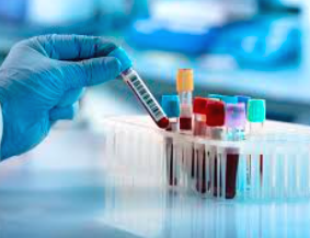 L&rsquo;Institut Pasteur installe son premier laboratoire à Touba