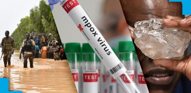 Kenya: premier cas de mpox dans la capitale Nairobi