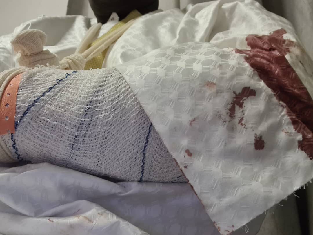 Attaque du convoi de Ousmane Sonko á Koungheul : Le Grand Parti condamne fermement et souhaite bon rétablissement á Malick Gackou