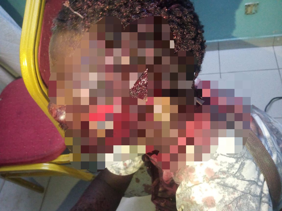 Nioro : Un conducteur de vélo-taxi sauvagement agressé