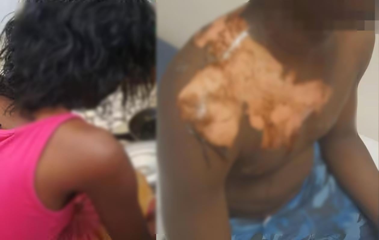Thieudem Peulh :Une femme ébouillante son mari et sa coépouse en plein ménage polygame